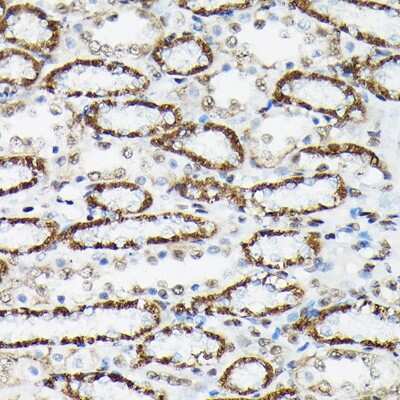Immunohistochemistry-Paraffin: FOXO3 [p Ser425] Antibody - Azide and BSA Free [NBP3-16945]